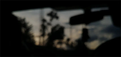 白內(nèi)障手術